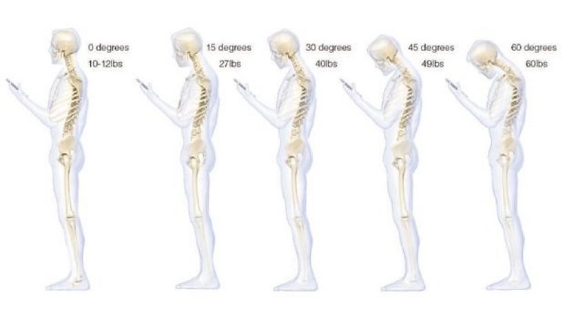 How you can you Improve Bad Posture and neck pain